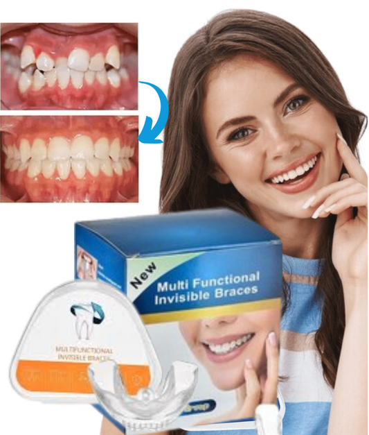 دعامة تقويم الأسنان غير المرئية